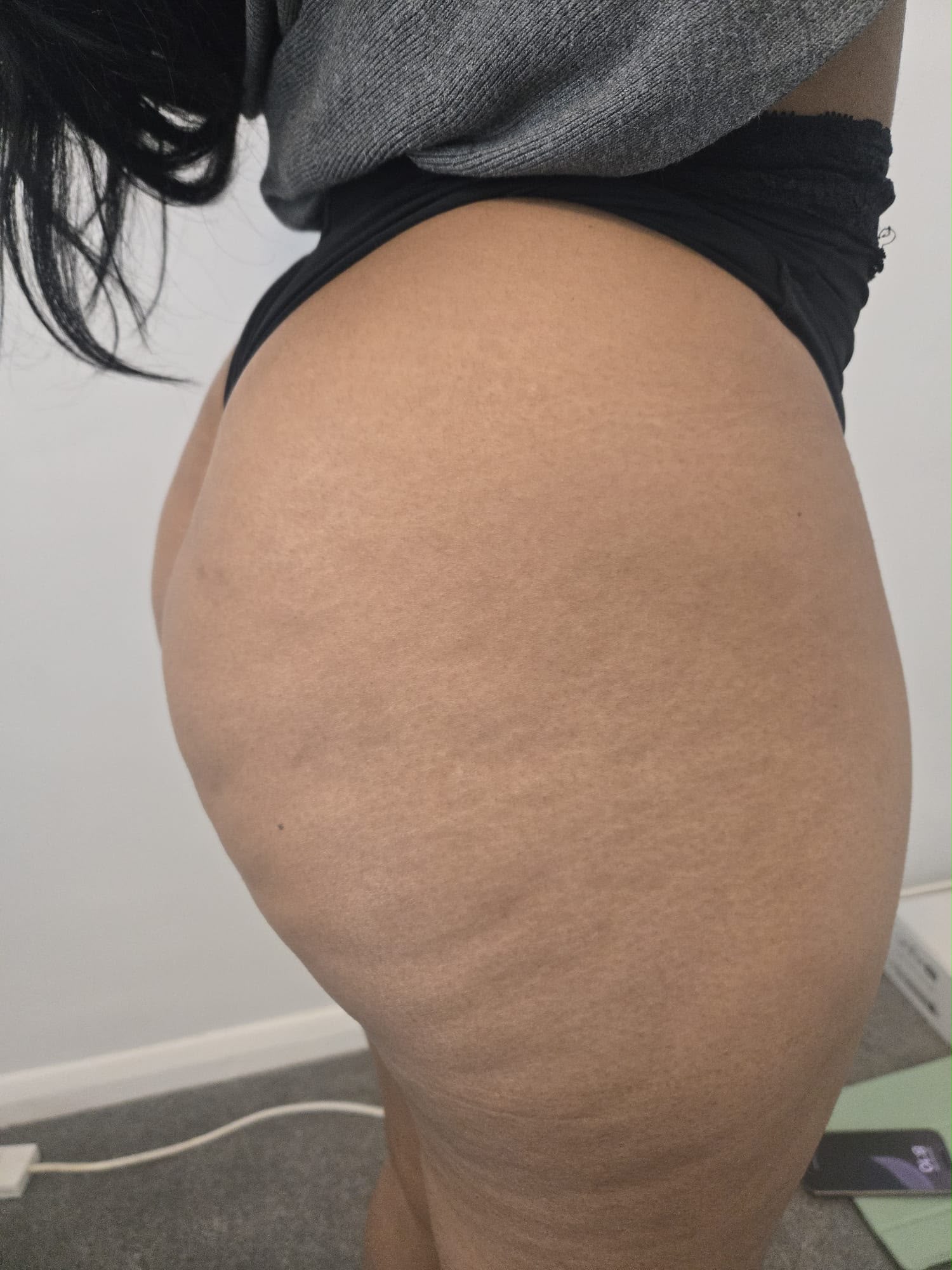 Client before Liquid BBL treatment — standing side view of natural shape